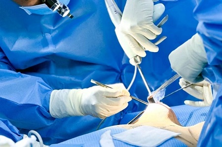 Ứng dụng mê mask thanh quản trong phẫu thuật tháo túi ngực: Phân tích cơ chế, ưu điểm và tính an toàn